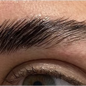 Formation lift brows