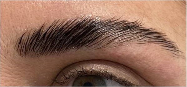 Formation lift brows